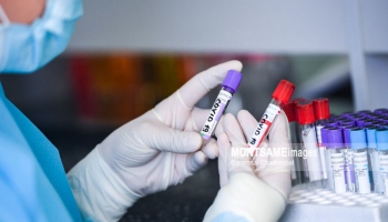 Ulaanbaatar “Mongolia ready to receive COVID-19 vaccines”